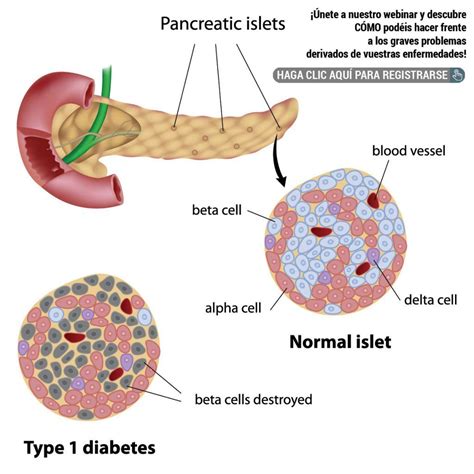 nas celulas beta pancreaticas glut 2 - Resumo: Pâncreas Endócrino 